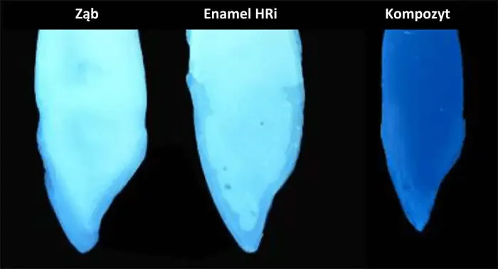 stabilnosc-i-kontrola-radiologiczna