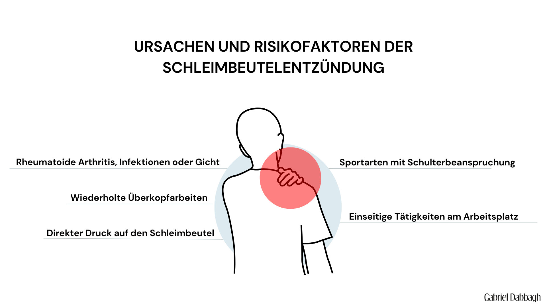Grafik mit einer stilisierten Figur, die sich die schmerzende Schulter hält, hervorgehoben durch einen roten Kreis. Um die Figur sind Risikofaktoren für eine Schleimbeutelentzündung angeordnet.
