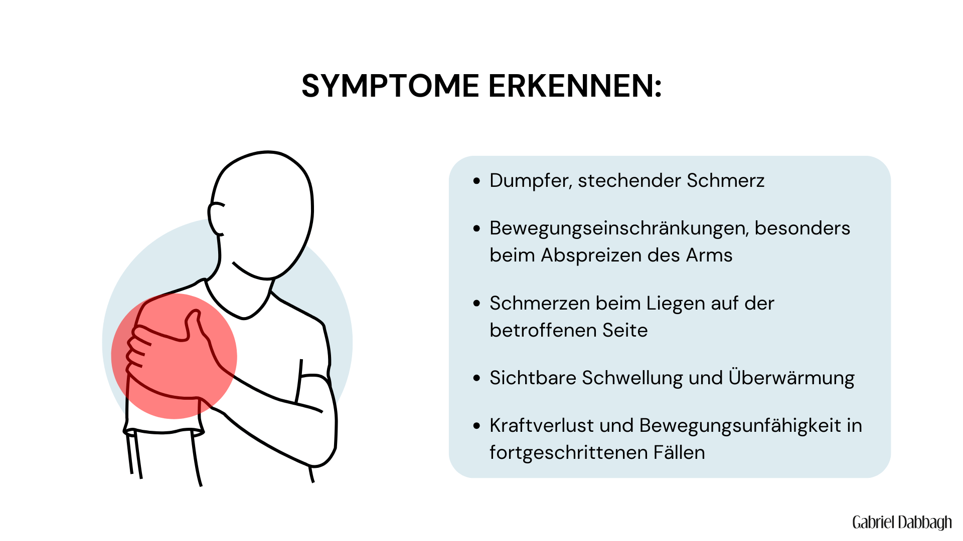 Illustration einer Person, die sich an die linke Schulter fasst, wobei ein roter Kreis eine Schmerzregion markiert. Daneben eine Auflistung typischer Symptome einer Schleimbeutelentzündung.