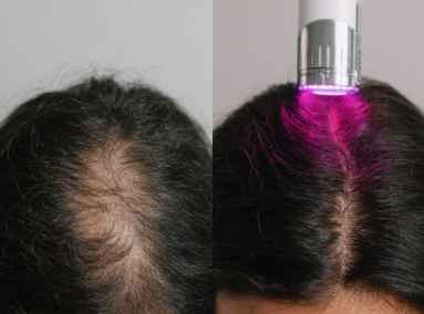 Red Light Therapy Executive Summary for Professionals: Specs, Safety, and Use Cases—2025 Update