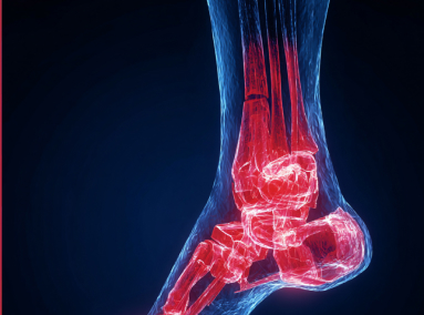 2025 Ultimate Guide: Harness Red Light Therapy to Conquer Plantar Fasciitis Pain