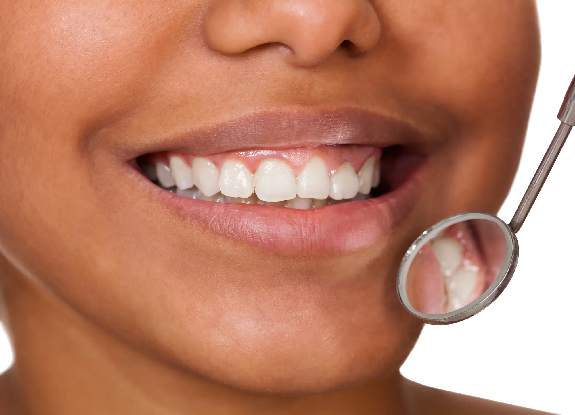 Healthy Teeth at Dentist in Bradenton, FL