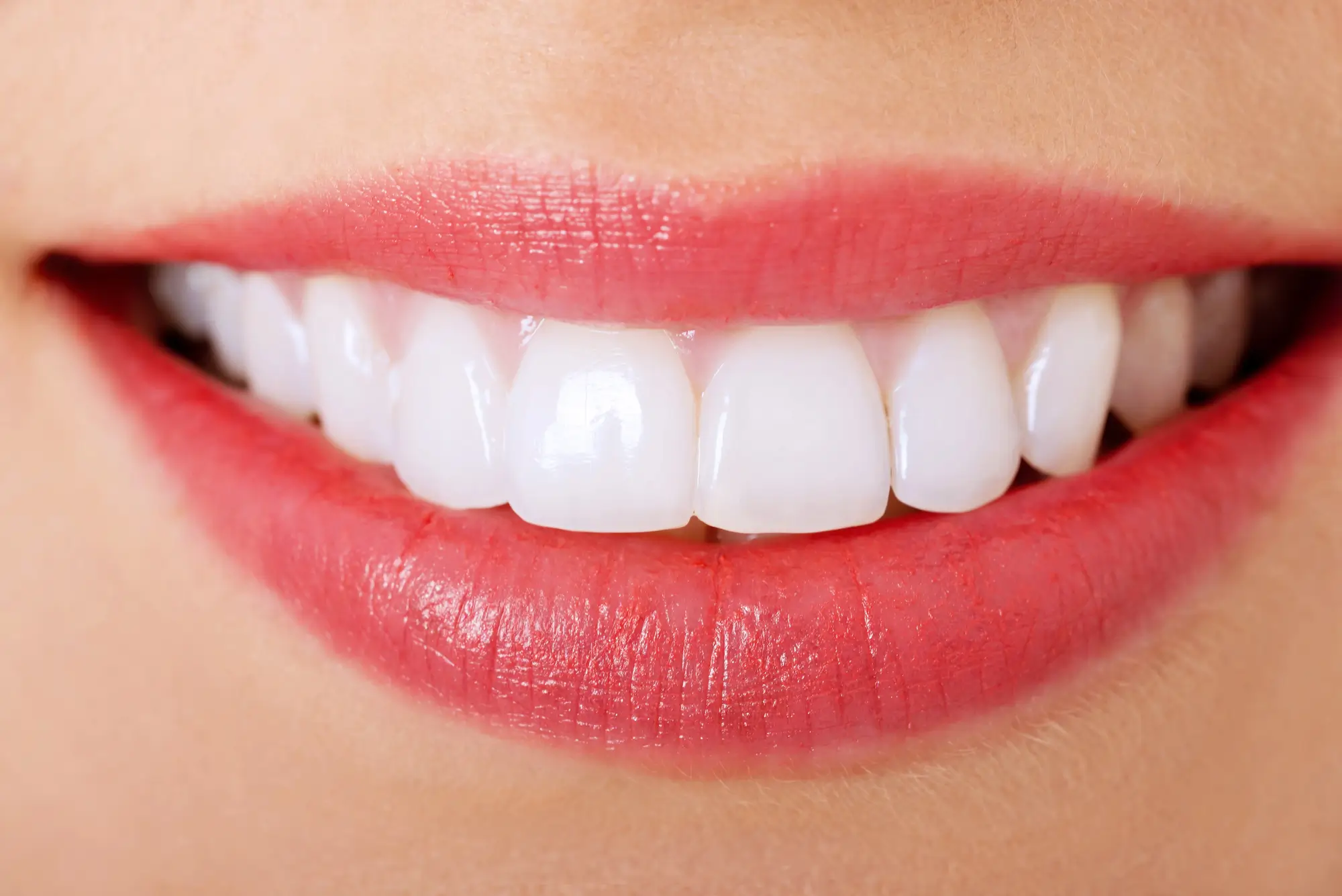 Perfect Smile with Clearwater Dentistry