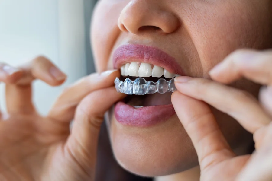 Woman inserting an Invisalign aligner in Clearwater, FL