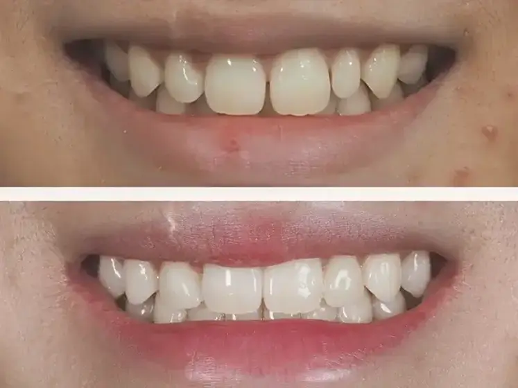 Before After Case 1