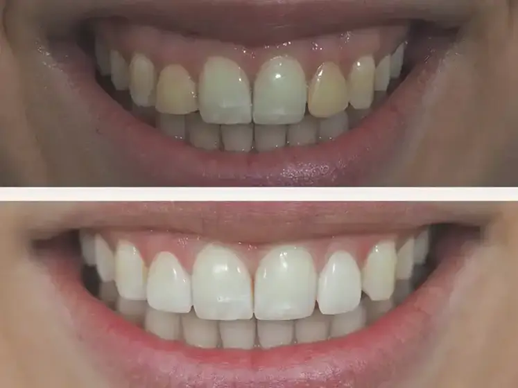 Before After Case 2