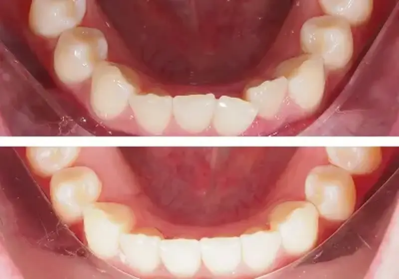 Before After Case 6