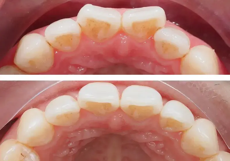 Before After Case 8