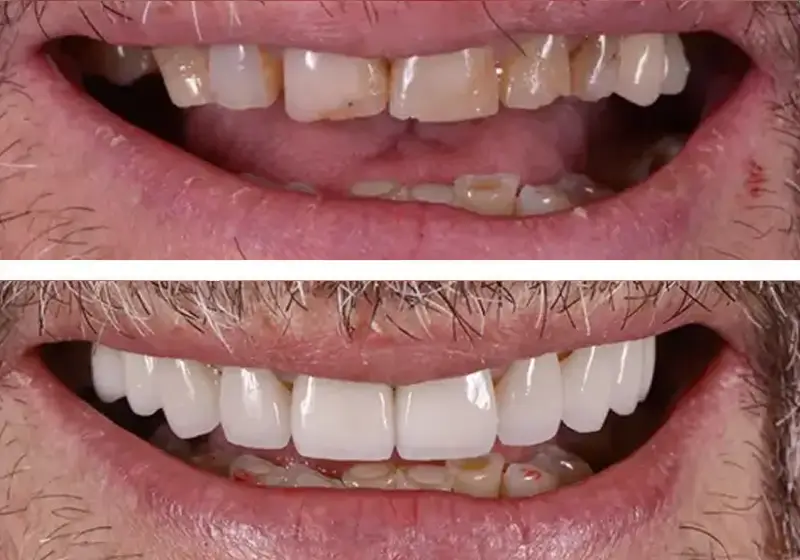 Before After Case 9