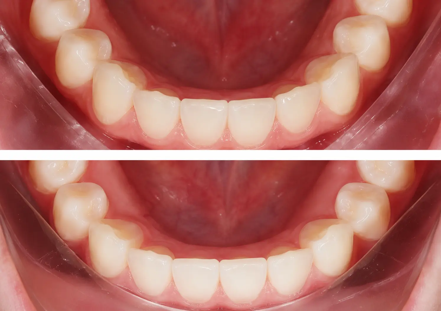 Before After Case 6