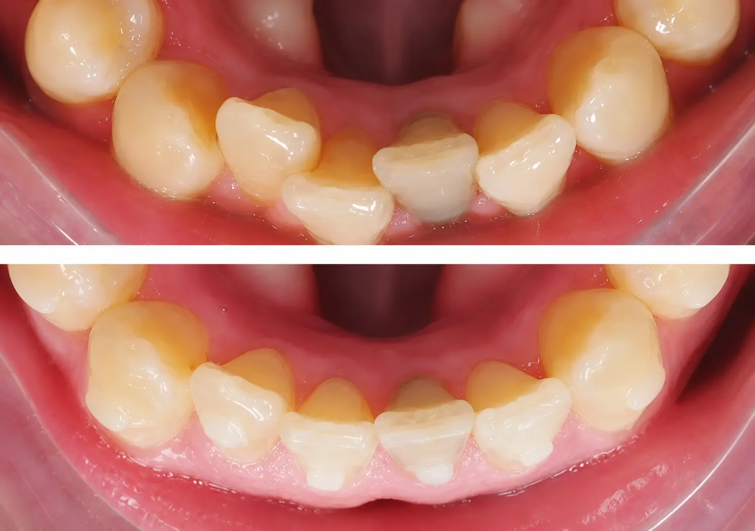 Before After Case 7