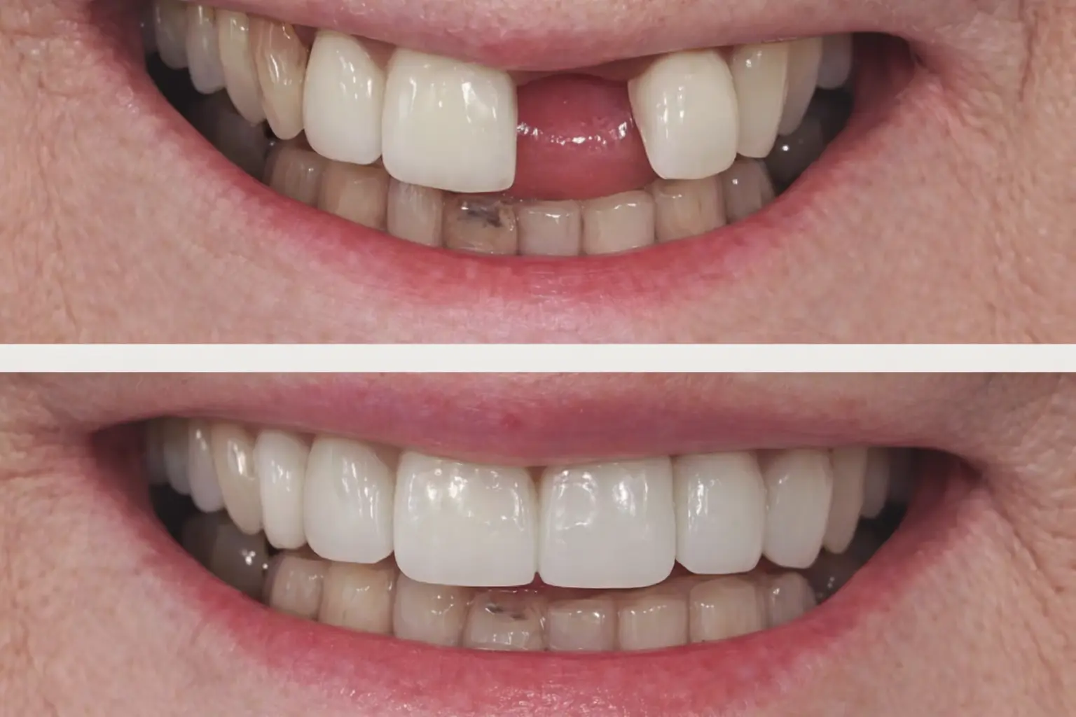 Before After Case 4