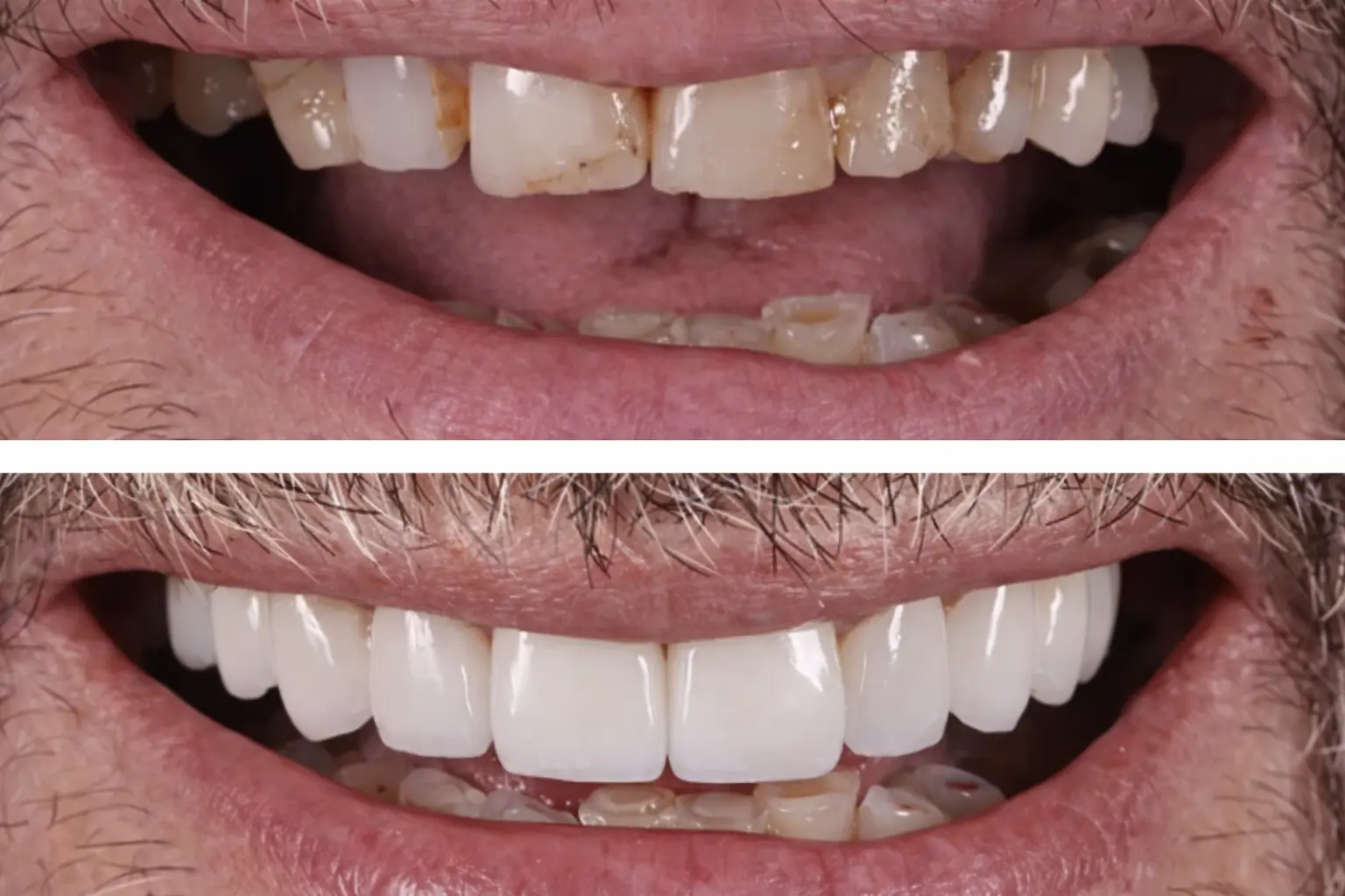 Before After Case 9