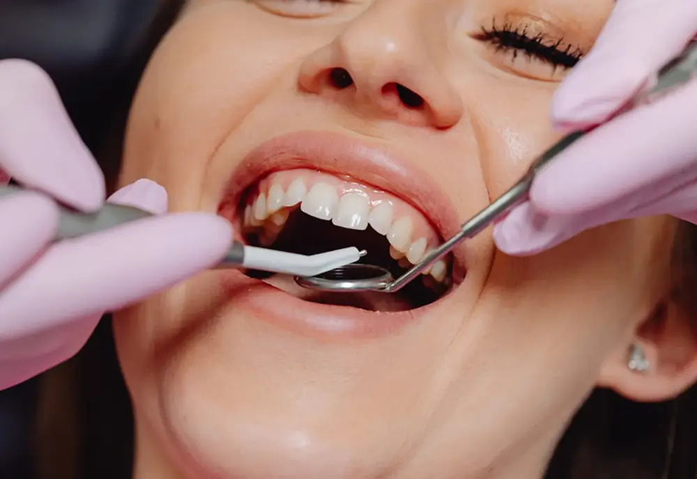 Who are veneers suitable for?