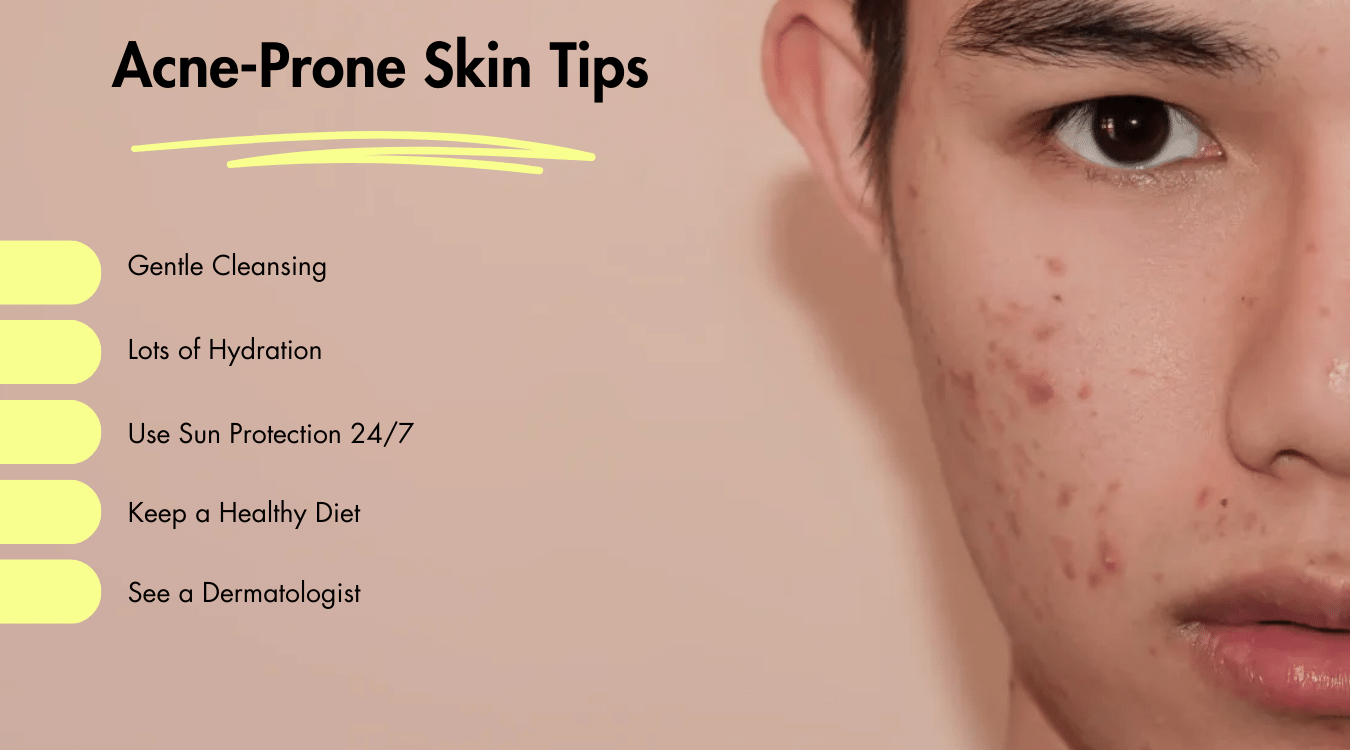 What Age Is Acne the Worst? Peak Years Explained