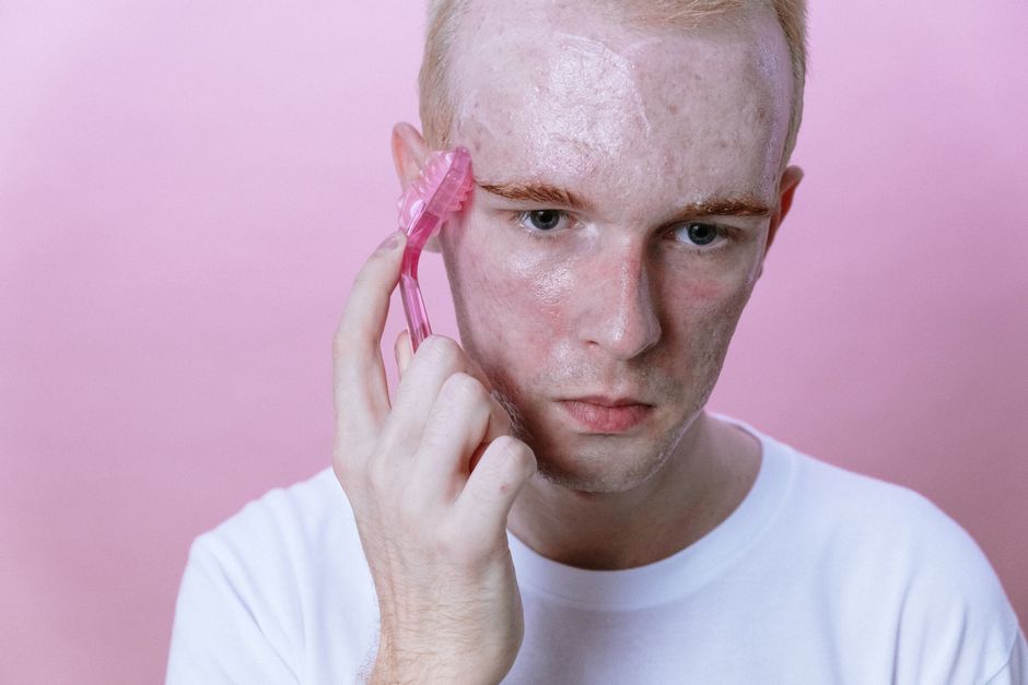 does adderall cause acne