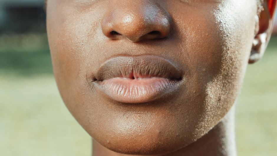 Hyperpigmentation Around Mouth: Causes & How to Fix It