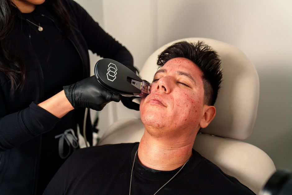 face reality advanced acne med