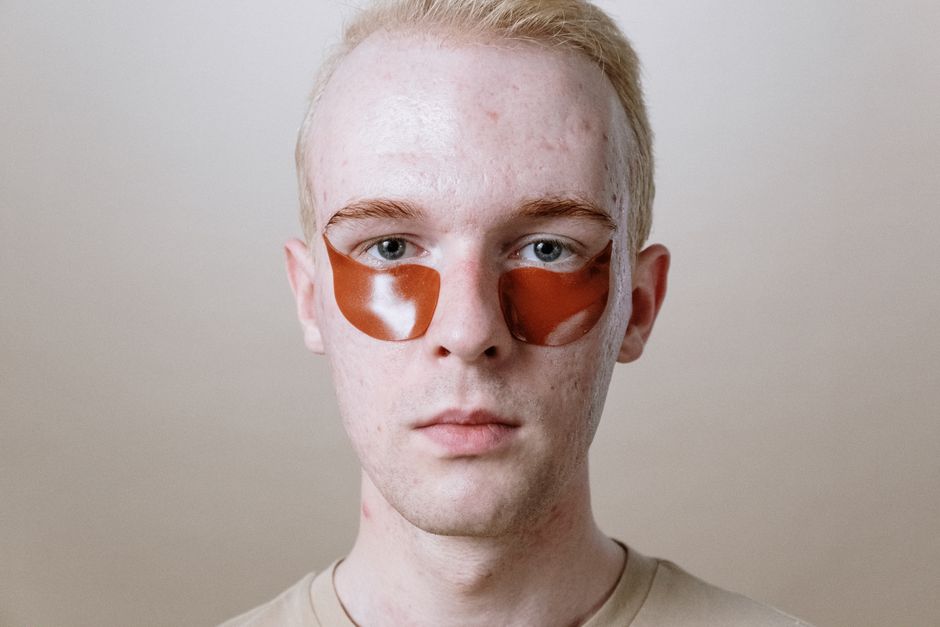 korean cosmetics acne