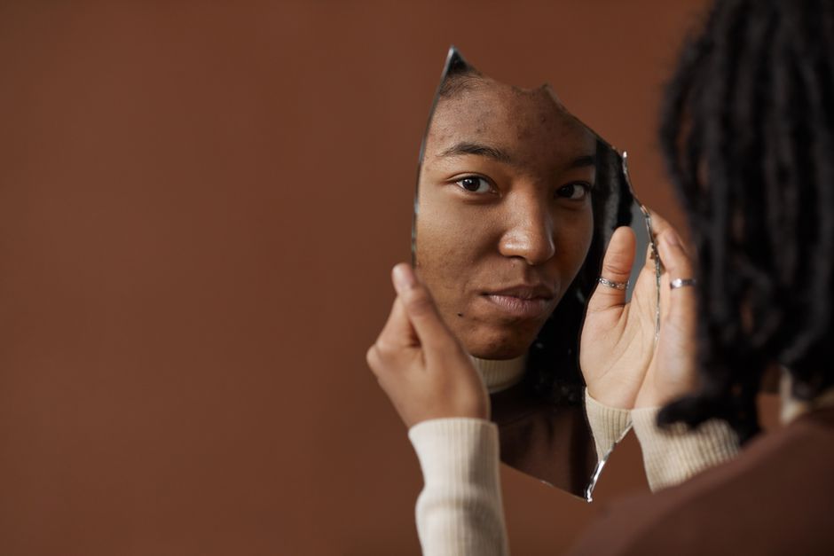 does exercise help acne