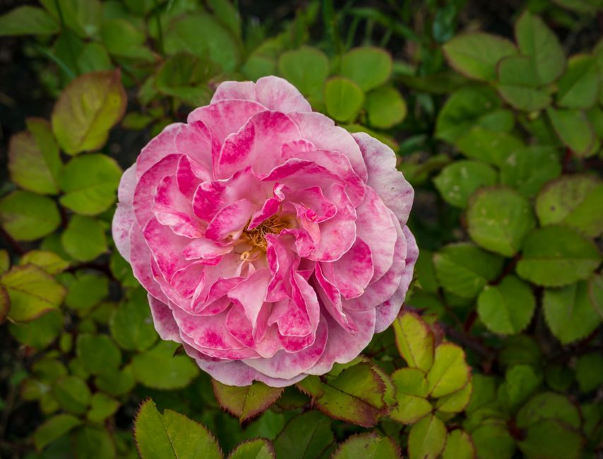Granulomatous Rosacea: Causes, Treatment & Skincare
