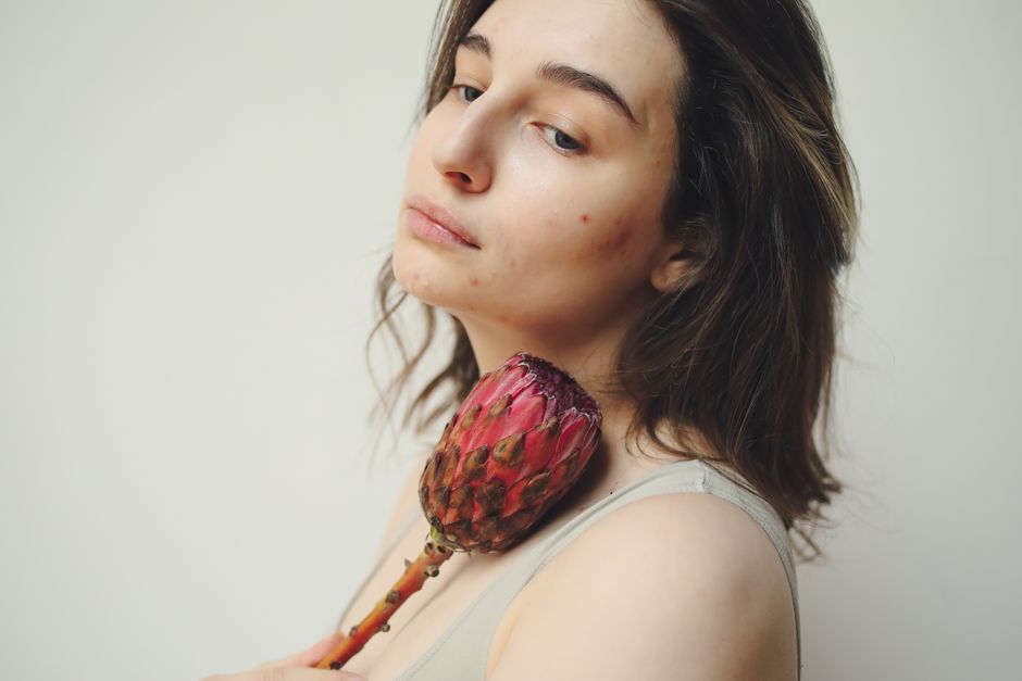 Fungal Acne vs Bacterial Acne: How to Identify & Treat Each