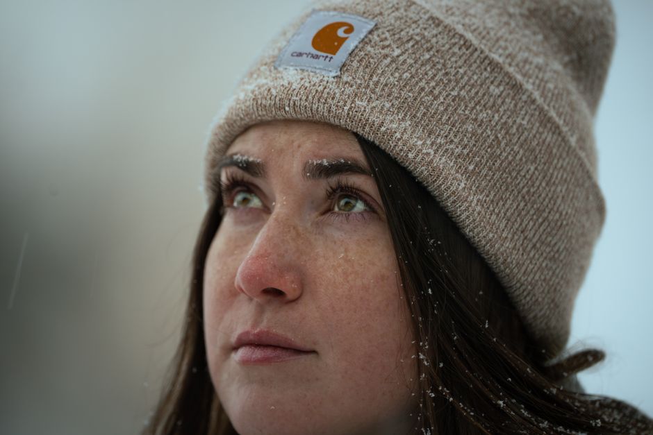 Why Hyperpigmentation Looks Worse When Cold: Winter Skincare Guide