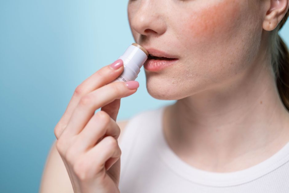 eczema lip balm