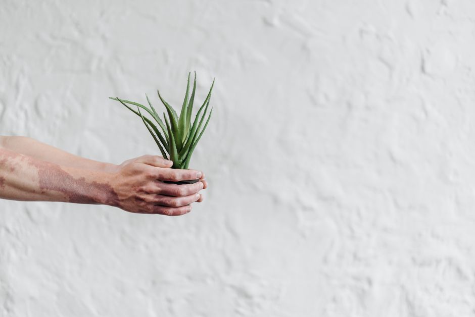 aloe for eczema
