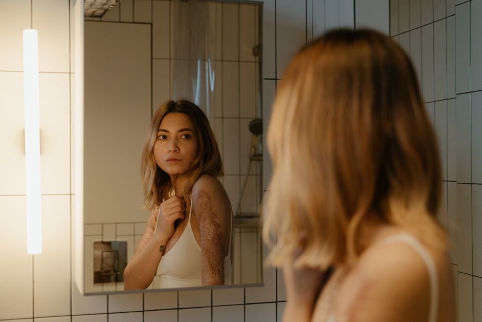 Images of Hyperpigmentation: What to Look For & How to Treat It