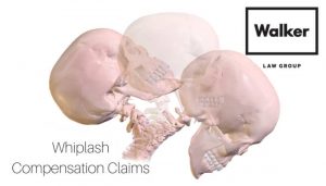 Whiplash Compensation Claim Lawyer Sydney