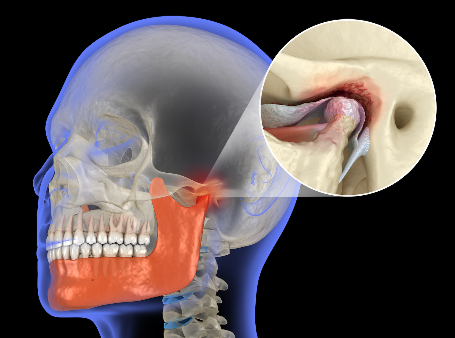 A diagram showing TMJ