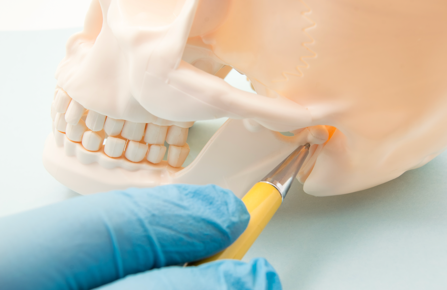 A model of human skull showing the origin of pain for TMJ patients