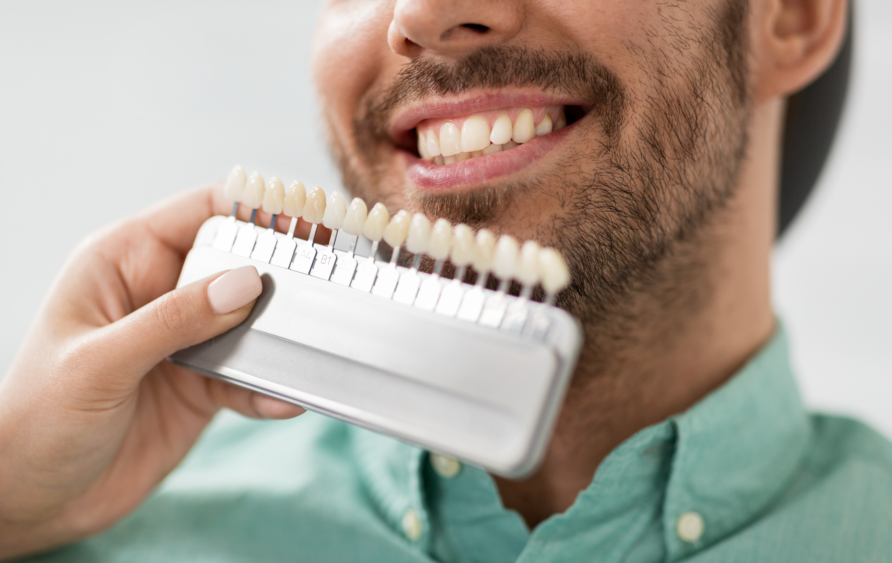 Various options of both Cosmetic Bonding and Veneers offered by Hall Dental Studio at Brentwood, Nashville