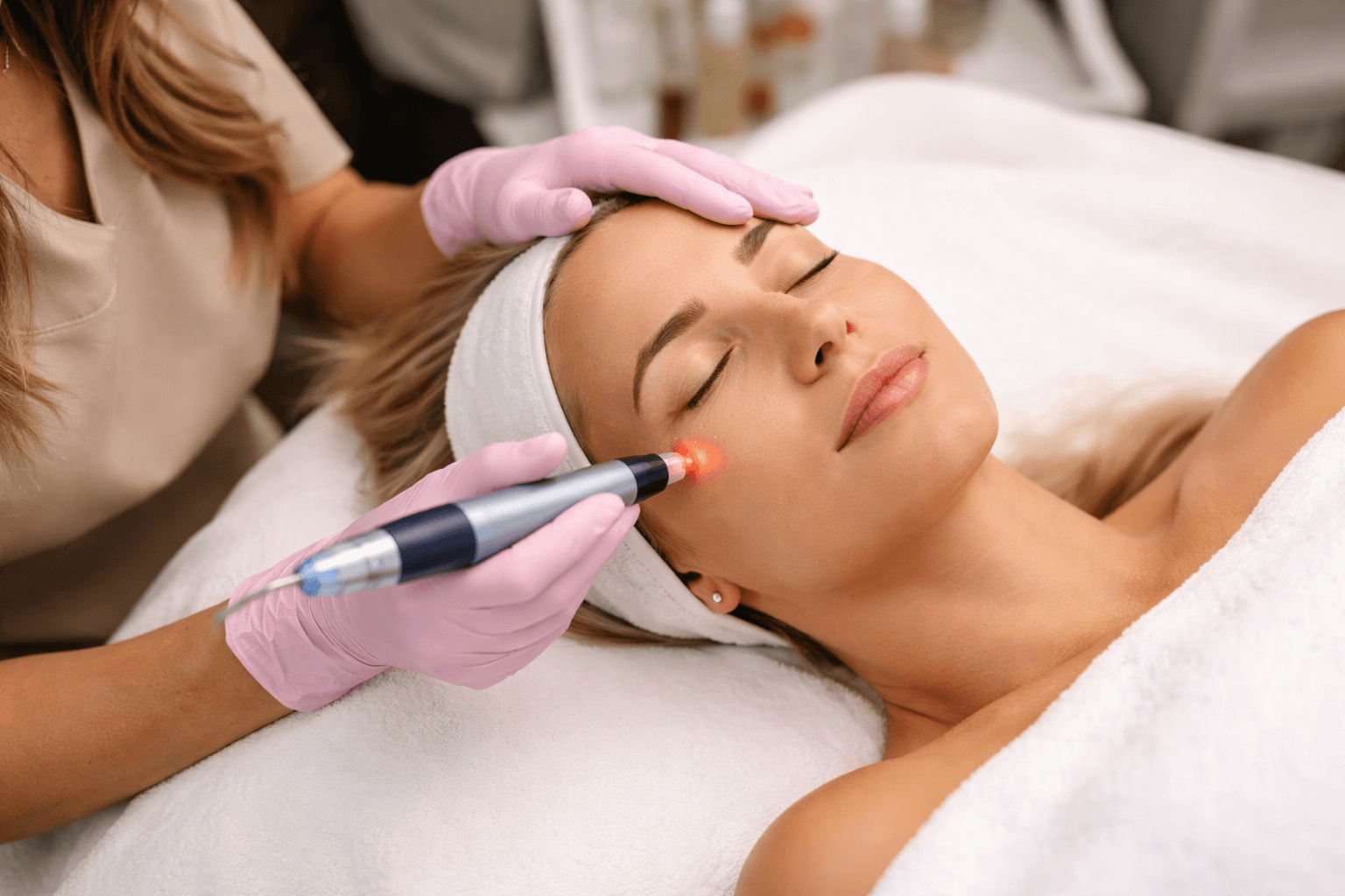 Patient receiving microneedling treatment for acne scars in Torrance, California, med-spa clinic