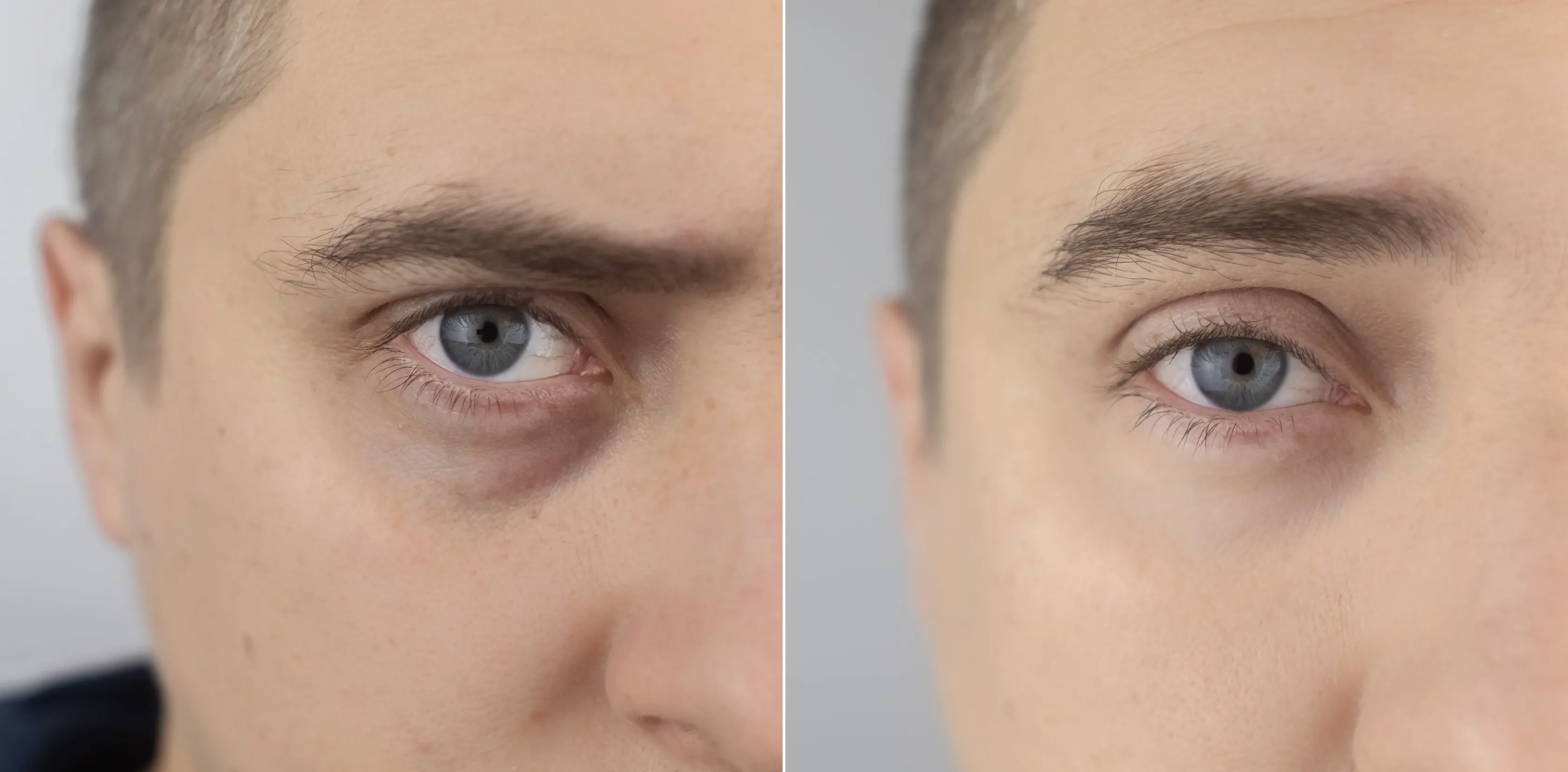 a picture in what showing differs between not using or using eyes putch rejuvenator