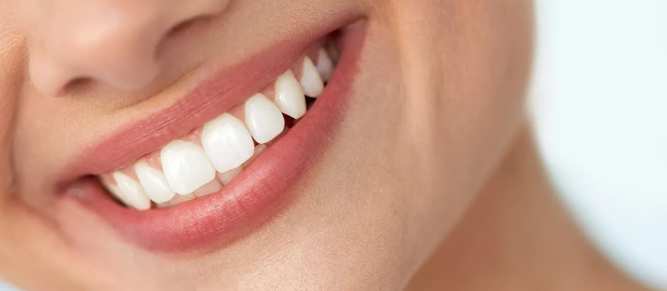Close-up of a woman’s beautiful smile with healthy, white teeth after a full mouth reconstruction in Los Angeles