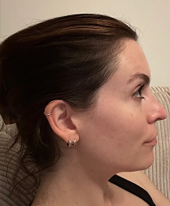 Month 6