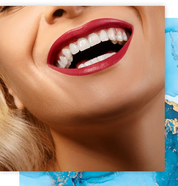 Bright, even smile, porcelain veneers at Soda City Dentistry in Cayce, SC
