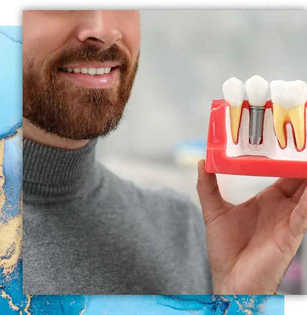 Smiling man holding a dental implant model, dental implants at Soda City Dentistry in Cayce, SC