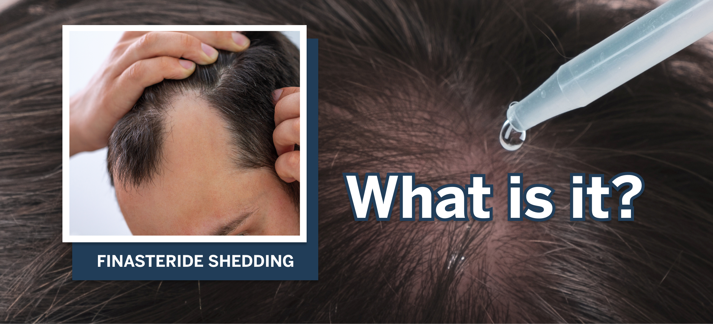 Hair Loss Journal: How to Monitor Shedding Patterns Over Time 