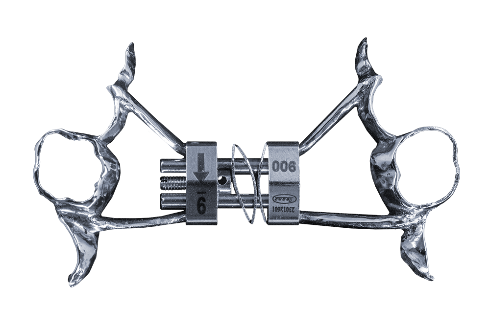 Silver metal dental orthodontic leaf expander