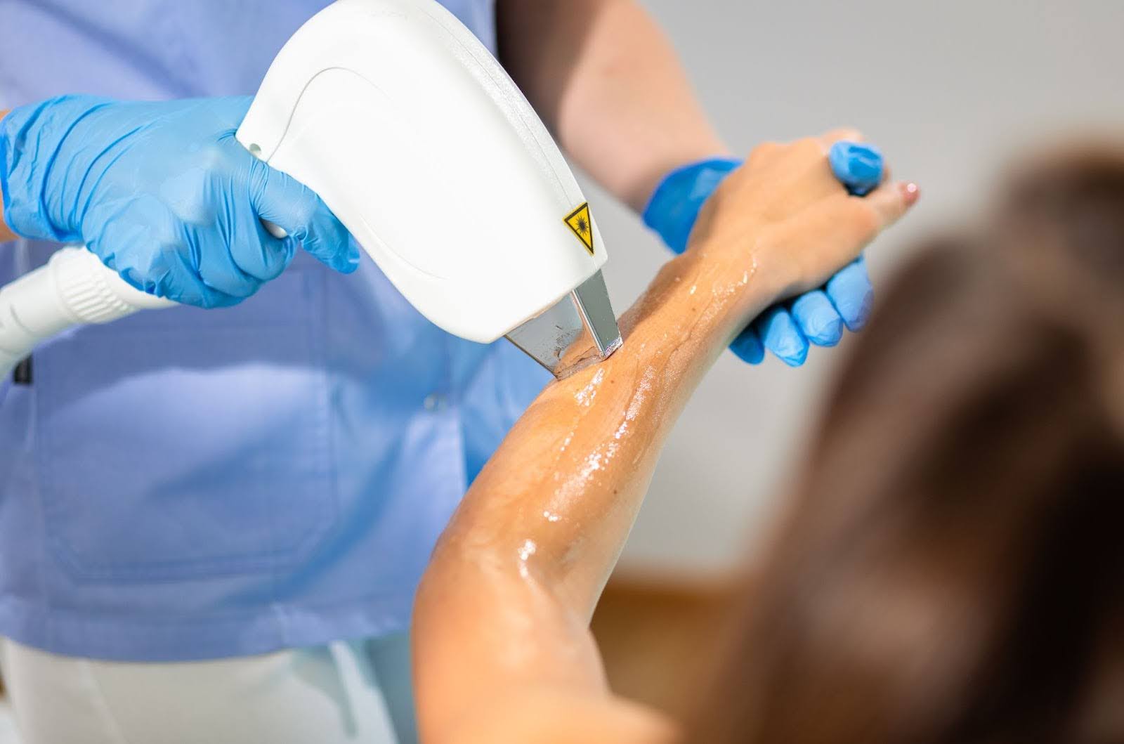 Client undergoing laser hair removal on her left arm.