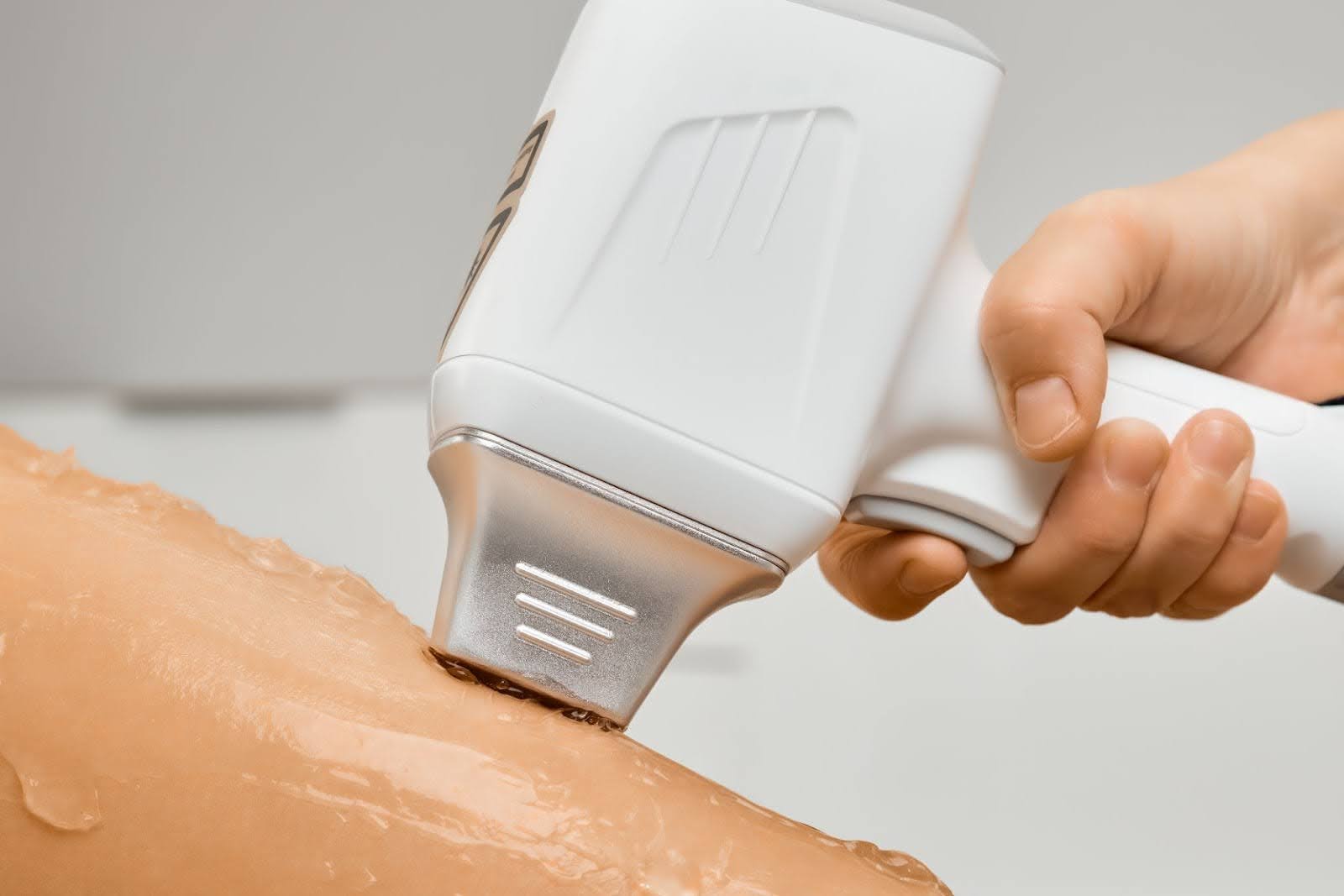 Close-up of professional laser hair removal treatment on the client’s leg.