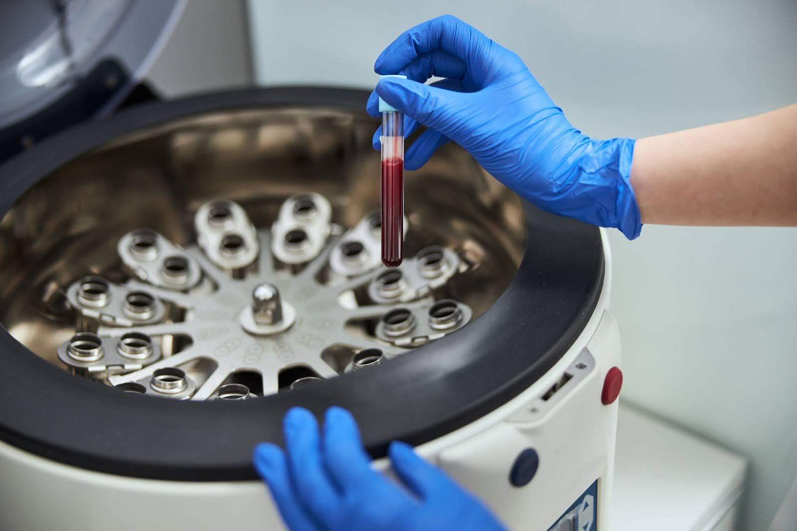 Hands loading a blood sample into a lab device to separate platelet rich plasma.