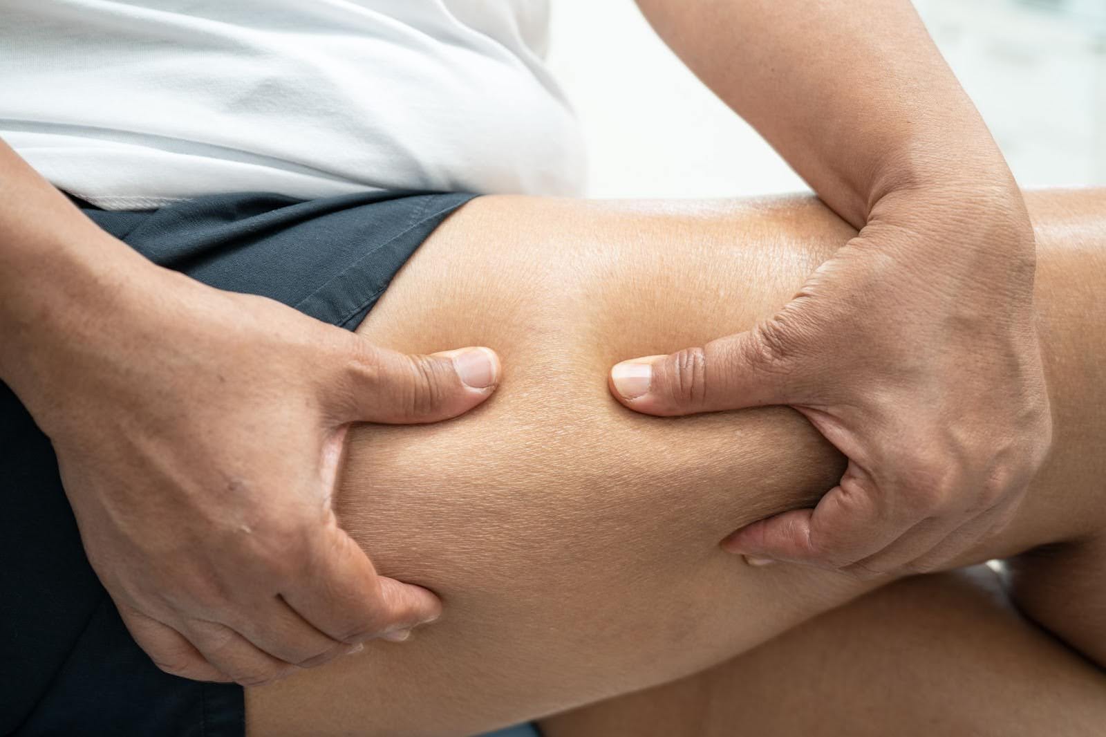 Woman pushing down on skin on her leg.