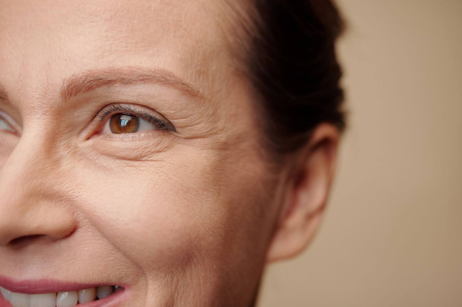 Side view of a woman highlighting the wrinkles around the eyes.