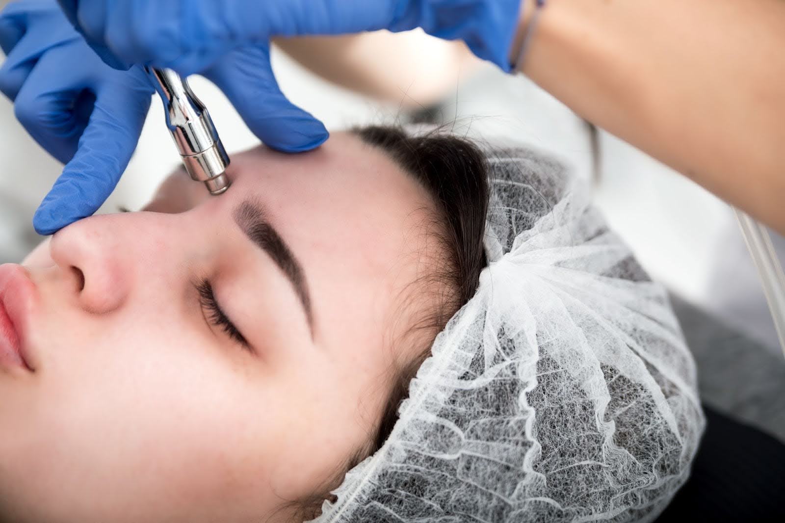 Close-up of a professional microdermabrasion procedure in progress.