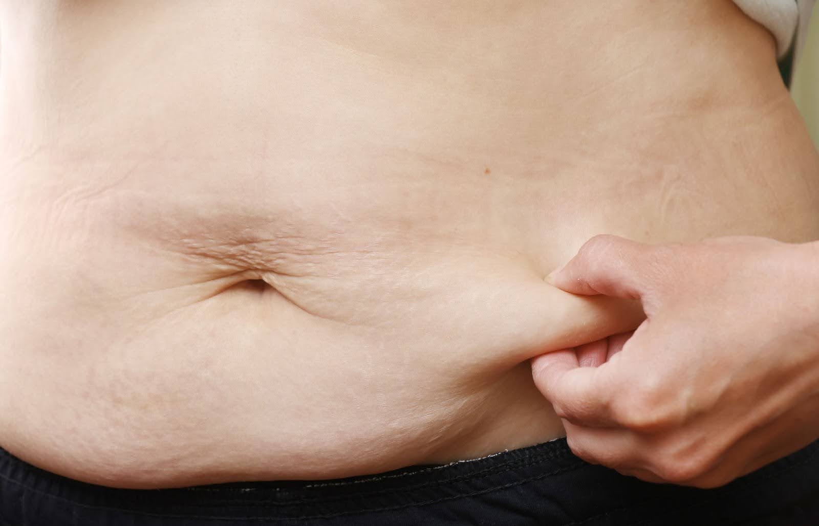 Close-up of a hand gently pinching loose skin on her lower abdomen.