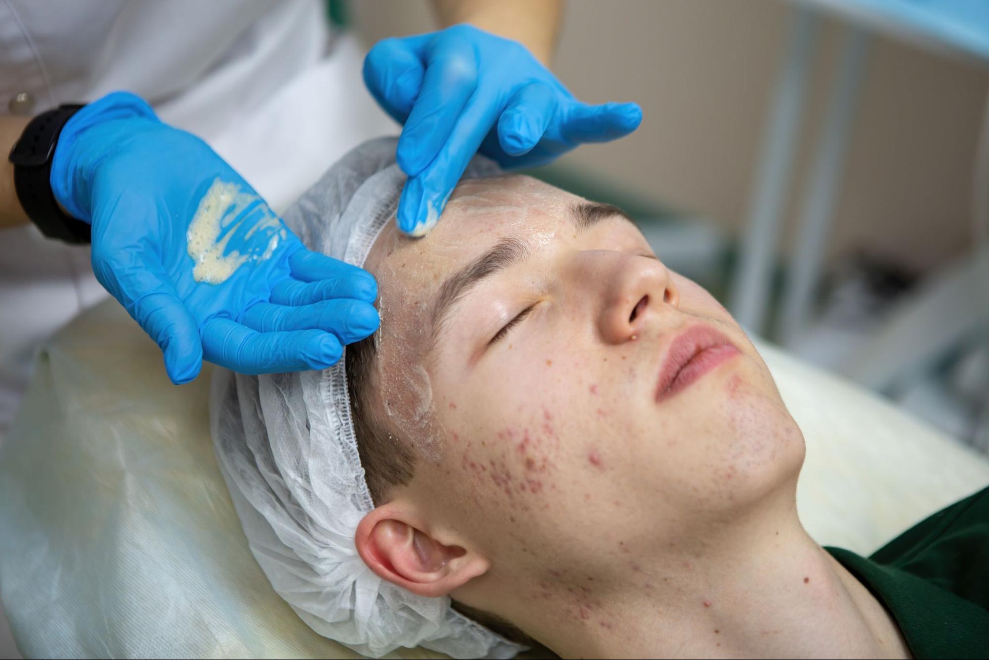 Teenage boy undergoing professional acne care with facial cleansing treatment.